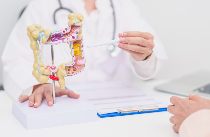 Colorectal Cancer Tops Male Cancer Cases in Malaysia, Hitting Younger Adults